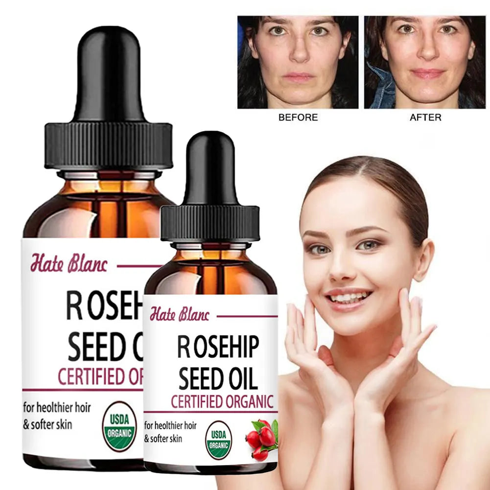 Pure Essential Oils Rosehip Oil Moisturizing Brighten Skin Color Essential Oil Anti-Dry Anti-Aging Face Essential