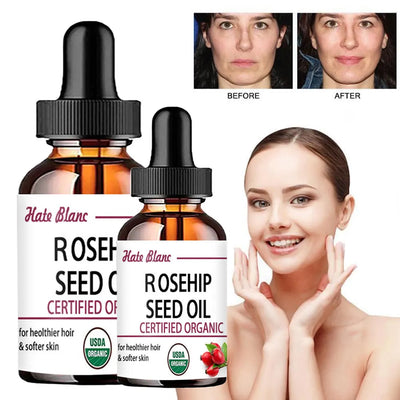 Pure Essential Oils Rosehip Oil Moisturizing Brighten Skin Color Essential Oil Anti-Dry Anti-Aging Face Essential